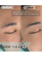 ルアン 六本木店/v