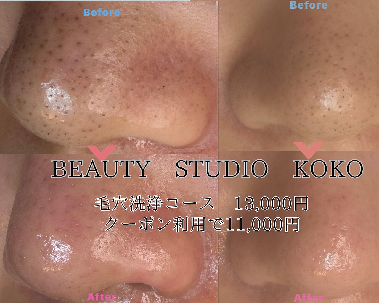 ココ(Koko)｜ホットペッパービューティー
