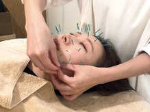 アオイ(Aoi)の雰囲気（“全身美容鍼”で肌・体・心を整え根本からキレイをつくります。）