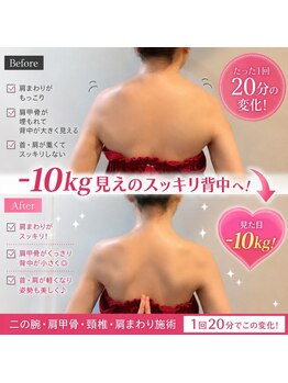 ルルエステ アンド 整体院(Lulu)/背中美人☆肩凝り、背中張り改善