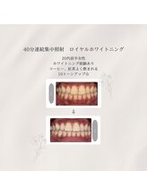 プラスビーセルフ(+b self)/ホワイトニングビフォーアフター