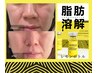 【なくなり次第終了】最強小顔レモンボトル×プラズマで導入21000円→9900円