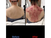 シュガーリングハウスレディ(SugaringHouse LADY)/40分で得られるスッキリ感の虜に