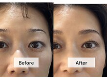 アンドミー 月島店(and me.)/40代/眉デザインWAXまつげパーマ