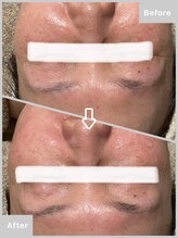 ゆりの花/フェイシャル+ピュアエッセンス