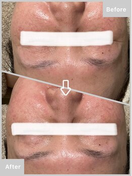 ゆりの花/フェイシャル+ピュアエッセンス