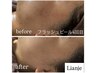 次世代ピーリング!フラッシュピール1回 毛穴の開き、ニキビ、脂っぽい肌質