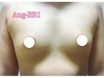 アンジェリークBB バストパレット本店/初回【Ang-BB1ケース】20代後半