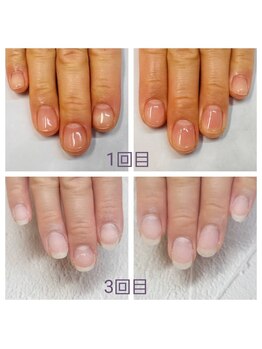 グレースレディ 神戸北店/