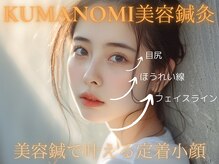 クマノミ美容鍼灸 イオン上尾院(KUMANOMI美容鍼灸)