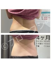 フローフシ∞/【集中痩せ】4ヶ月で-10.5cm