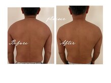 プレジールサロン(plaisir salon)/◇上半身スッキリ◇