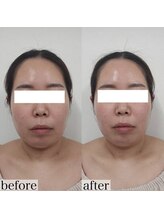 ヴェルシック(Belchic)/輪郭が変われば印象も変わる