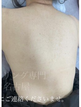 リベル 名古屋(Lebelle:)/ハーブピーリング専門名古屋