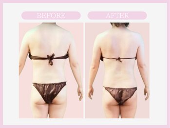 スリムライン 盛岡店(The Slim Line)/before→after