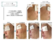 ベルスタイル(Bell style)/当店のお客様症例