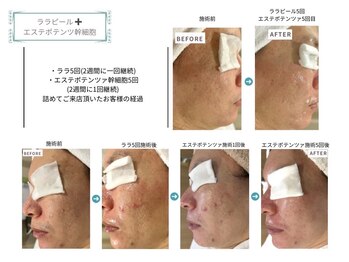 ベルスタイル(Bell style)/当店のお客様症例