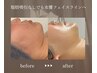 new ヴァーグリフト×リフトマッサージ90分 通常35,400円