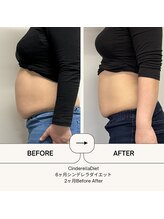 オーシャン整骨院(OCEAN整骨院)/６ヶ月ダイエットコース