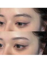 アビス 茅野諏訪(Aviss)/優しい印象に