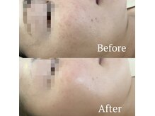 サロンディア(SALON Dea)の雰囲気（次世代ハーブピーリングでハリのある透明感のあるお肌へ改善◎）
