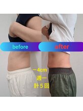 整骨院がじゅまる堂/［EMSダイエット] before/after