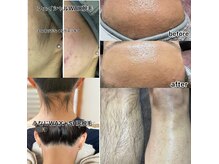 ルナソル 昭島店(LUNASOL)の雰囲気（施術部位によってWAXを使い分けます！）