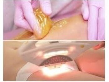 シュガーリングハウスレディ(SugaringHouse LADY)の写真/シュガーリング×光脱毛のダブル施術で今も未来も綺麗を叶える!!プライベートサロンで周りも気にならない♪