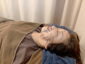 こじま 富雄団地接骨院/ヒト幹細胞美容鍼