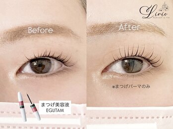 アイラッシュ リリオ(Lirio)/まつげ美容液/EGUTAM