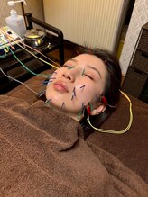 エウーゴ整骨院/美容鍼ですっきり！