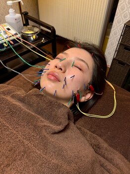 エウーゴ整骨院/美容鍼ですっきり!