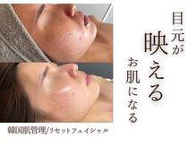 ミーサ(Mysarest)の雰囲気（《最新韓国肌管理》目元だけハッキリするのが苦手な方は肌もケア）