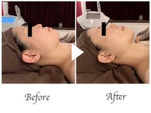 サロン ド プレシャス(Salon de Precious)/整体ストレッチリンパマッサージ