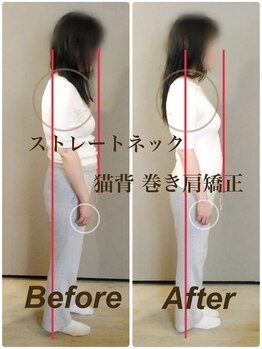 ティーエスエル とがし整体ラボ(TSL とがし整体 Labo)/姿勢矯正・猫背 巻き肩/美容整体