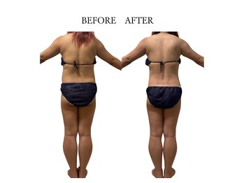 ヨサパーク サノン(YOSA PARK Sanon)/浮腫み取りましょう！