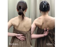 天使の羽づくり◎肩甲骨はがしが人気！