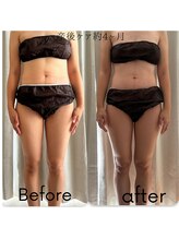 アカアカ('AKA'AKA)/産後ケア