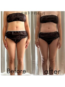 アカアカ('AKA'AKA)/産後ケア