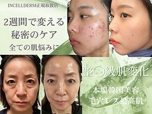 ヴィディトゥ(vidyto)