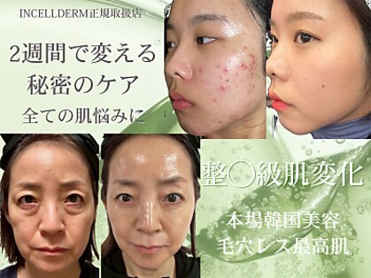 ヴィディトゥ(vidyto)の写真