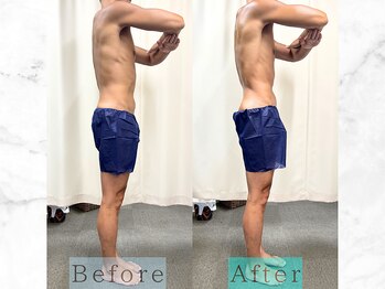 パラディ(PARADIS)/ハイパーナイフ/シェイプ