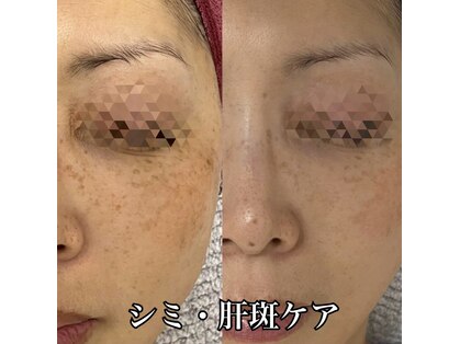 ビジュツ(BIJYUTSU)の写真