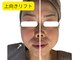 シェリー(CHERIE)の写真