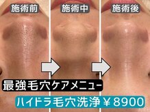 ブリリオ なんば店(Brillio)の雰囲気（Brillioメソッド肌質改善◆クリスティーナ等をフルライン導入）