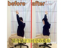 きずな鍼灸整骨院 武蔵ヶ丘本院/猫背矯正
