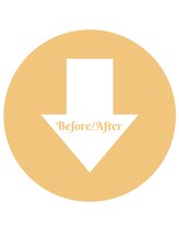 カルナ(CARNA)/施術Before →After 