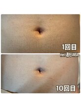 メンズ シンバ(SIMBA)/◯before→after◯