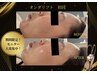 モニター急募★【話題のエステ版韓国オンダリフト！】小顔リフトUP￥25,000