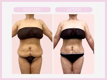 スリムライン 仙台店(The Slim Line)/before→after